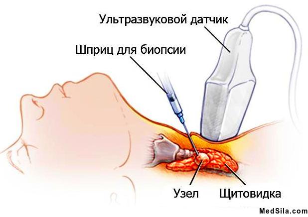 Виды методов диагностики заболеваний щитовидной железы