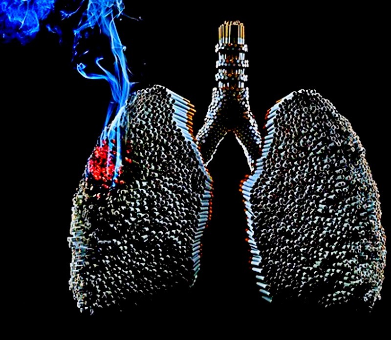 Образное представление легких курильщика