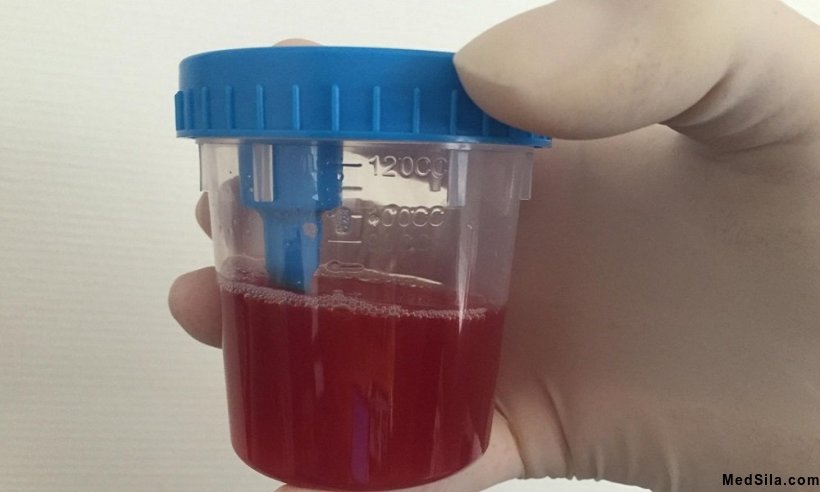 Цвет мясных помоев